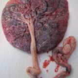C�� chi chiede alle ostretriche di conservare la propria placenta. Per farne cosa? Incredibile a dirsi: per mangiarselo. Sembra infatti che questa �dieta� porti a numerosi benefici, migliorando la produzione di latte, aumentando i livelli di ferro dopo il parto e aiutando a evitare la depressione post partum
